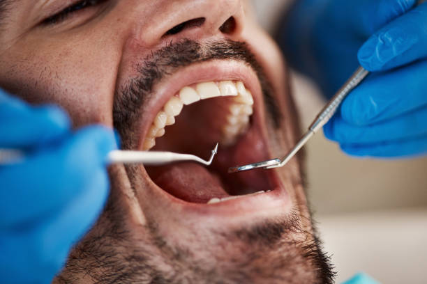 Best Tooth Infection Emergency Dentist  in Willard, MO